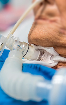 Entretien d’une trachéostomie reliée à un ventilateur